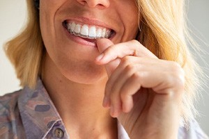 Woman placing Invisalign tray on her teeth
